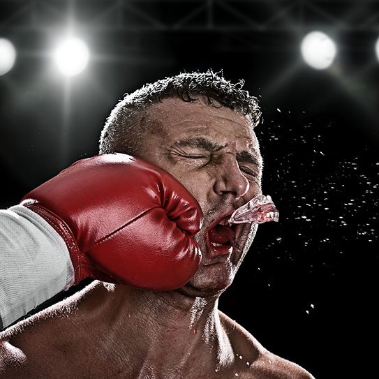Traumatic Injuries Matias Dental Group injuries